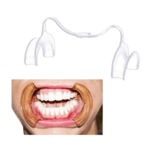 Alternative view of دهان باز کن داخلی با زبان گیر Cotisen Mouth Prop